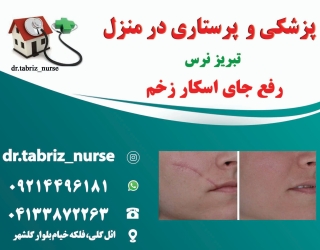 اسکار