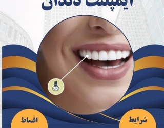 ایمپلنت دندان در مشهد با اقساط بلند مدت، بدون پیش پرداخت ( دیگه نگران هزینه‌ها نباش )