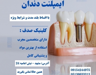 کاشت ایمپلنت بدون فشار مالی با اقساط بلند مدت