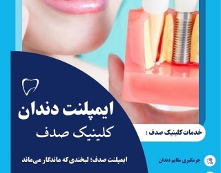 ایمپلنت دندان در مشهد ، کلینیک صدف