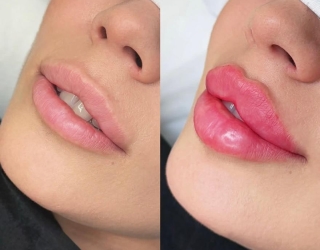 مرکز لیزر و پوست دلورا 