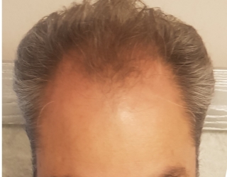 1000101088