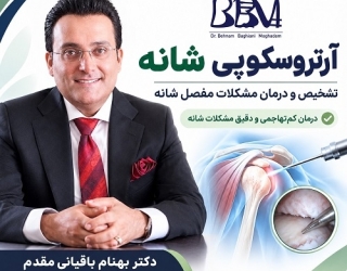 آرتروسکوپی شانه؛ درمان دقیق مشکلات مفصل شانه 
